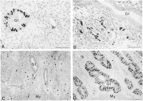 Proliferating Cells As Indicated By Ki 67 Staining Micrographs On The Download Scientific