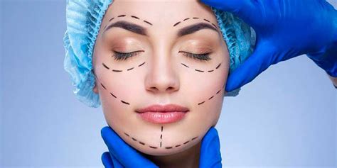 FACELIFT NECK LIFT Dr Shehab Soliman