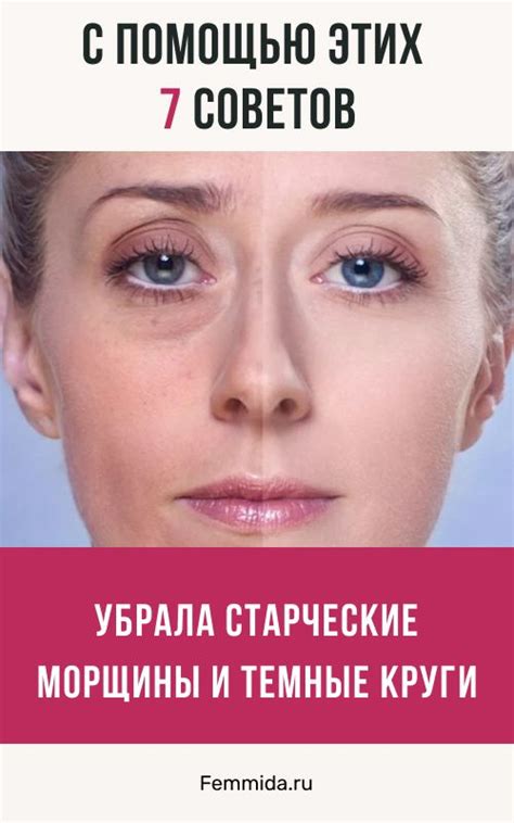 Молодость глаз: как сохранить в 2024 г | Морщины под глазами, Морщины ...