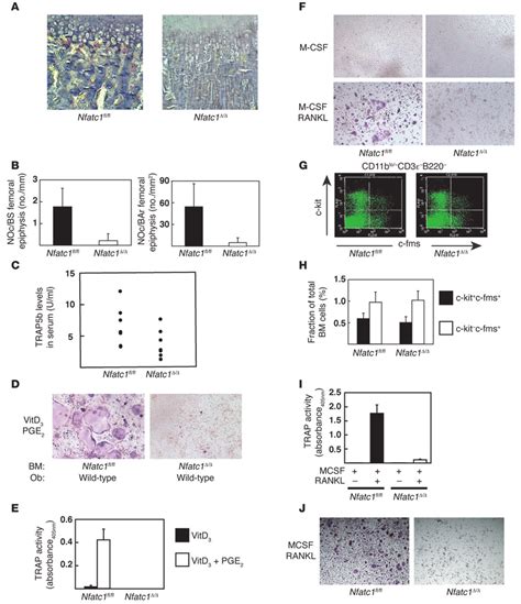 Nfatc1 Δ Δ Mice Display Impaired Osteoclast Differentiation In Vivo And Download Scientific