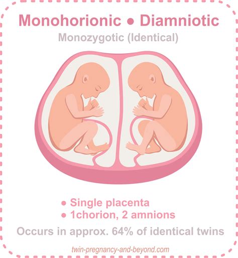 Placentation of Twins - How many placentas in a twin pregnancy?