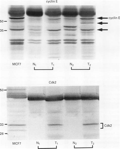 Western Blot Analysis For Cdk2 And Cyclin E Download Scientific Diagram