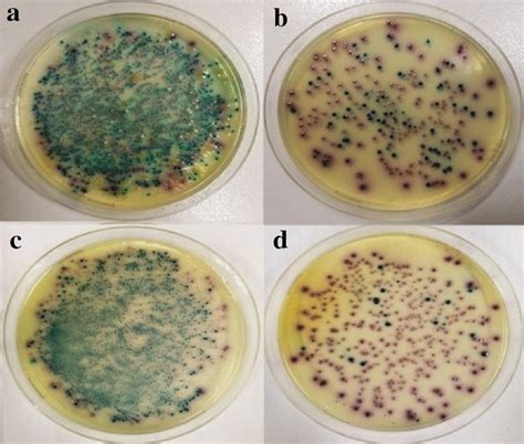 Chromagar Orientation Plates Showing Different Types Of Colonies