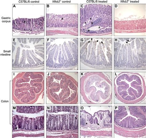 Importance Of The Alternative Nf B Activation Pathway In Inflammation