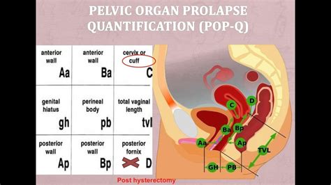 Pop Q Classification System Part 1 Youtube