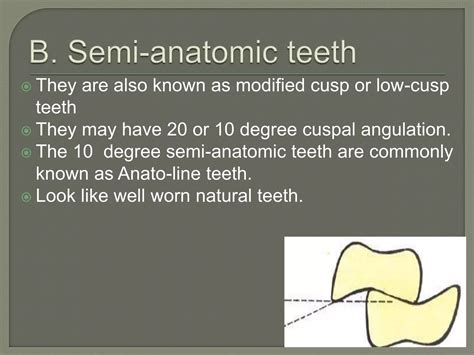 Posterior Teeth Selection in Complete Denture | PPT