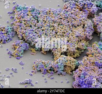 Lactococcus Lactis Bacteria Coloured Scanning Electron Micrograph Sem