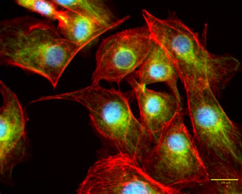 BPAE Cells Imaged With The CELENA S Logos Biosystems Advanced