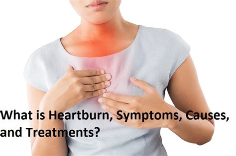 What Is Heartburn Symptoms Causes Treatments By Daily News Medium