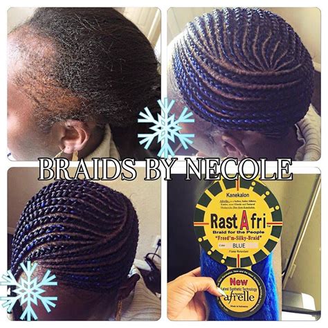 Braided Hairstyles To Cover Bald Edges Alopecia Braiding Braided