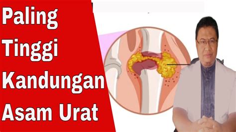 Minuman Yang Menyebabkan Kambuhnya Asam Urat Wajib Hindari Sekarang