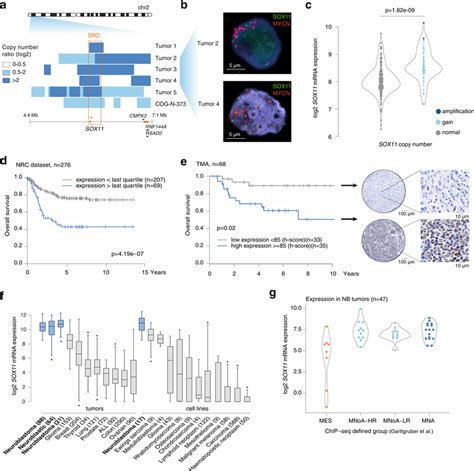 Rare Focal Amplifications And Lineage Specific Expression Of Sox In