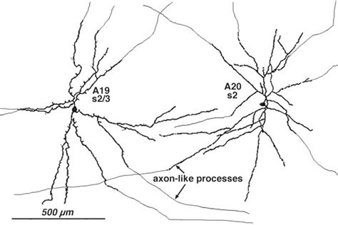 Roles Of Amacrine Cells By Helga Kolb Webvision Ncbi Bookshelf