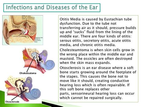 The Human Ear and Sound