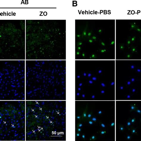 Zingerone Enhanced The Nrf Nuclear Translocation In Vivo And In Vitro