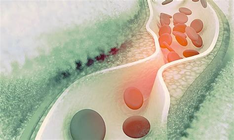 Sex Specific Differences Observed In Lipoprotein A Levels To Predict