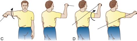 Throwers Ten Exercise Program Musculoskeletal Key