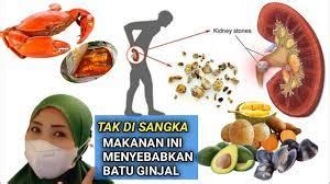 Ini Dia Makanan Dan Minuman Penyebab Batu Ginjal Segera Batasi