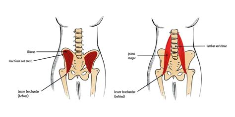 Tight lower back? It could be a psoas trigger point