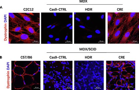 Effective Restoration Of Dystrophin Expression In IPSC Mdx Derived