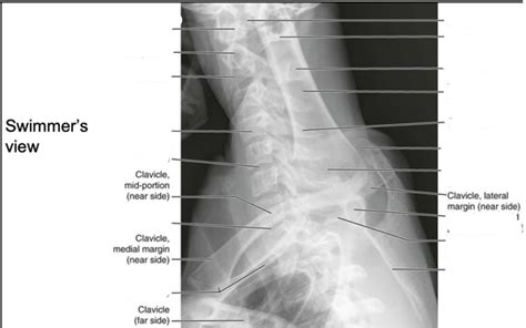 Swimmers View X Ray