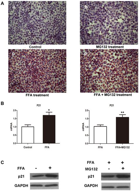 A Representative Micrographs Showing Intracellular Lipid Accumulation