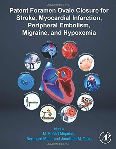 Pdf Patent Foramen Ovale Closure For Stroke Myocardial Infarction