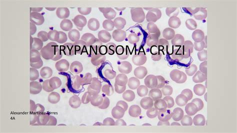 Trypanosoma Cruzi Alex Martínez Udocz