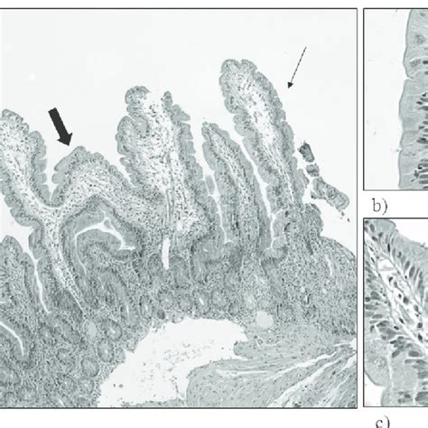 A Histological Picture Of Duodenal Mucosa Showing Normal Villous