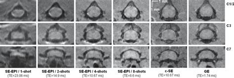 From Left To Right 1 2 4 And 8 Shot Spin Echo Epi Se Epi