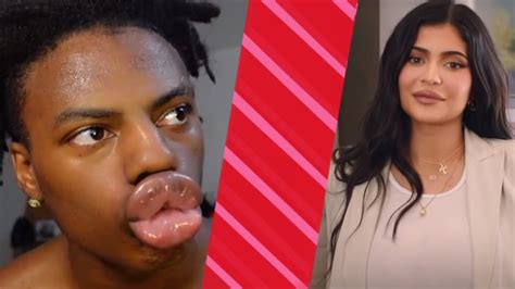 Ishowspeed Tries Kylie Jenner Lip Challenge Gone Wrong Calls The