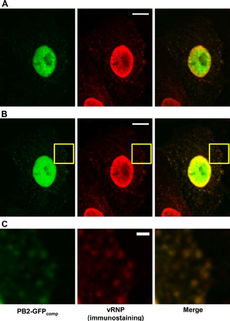 Colocalization Of The Pb Gfp Comp Signal With Vrnp Specific