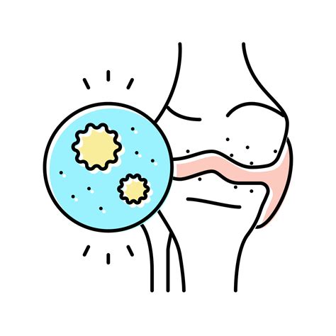 Ilustraci N De Vector De Icono De Color De Artritis Infecciosa