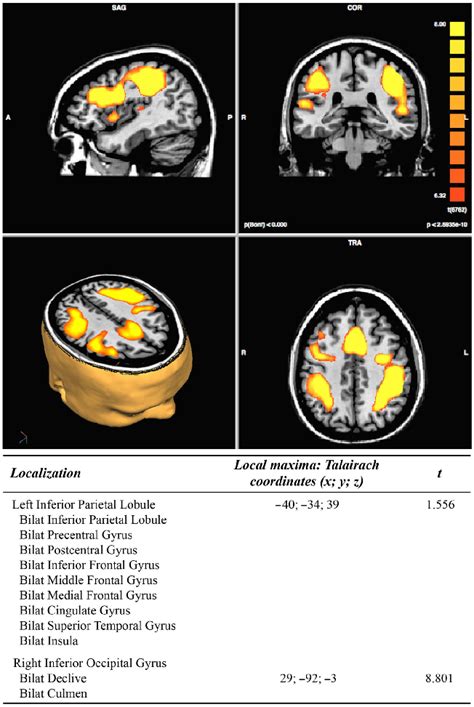 Results Of Pre Treatment Functional Magnetic Resonance Imaging Fmri Download Scientific