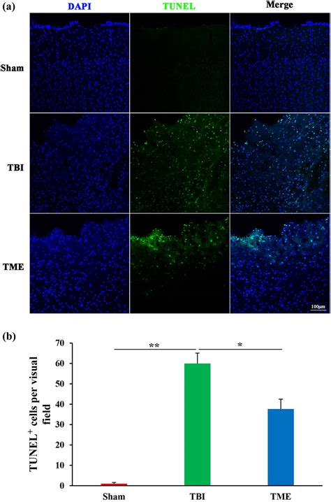 HIF 1α participates in secondary brain injury through regulating