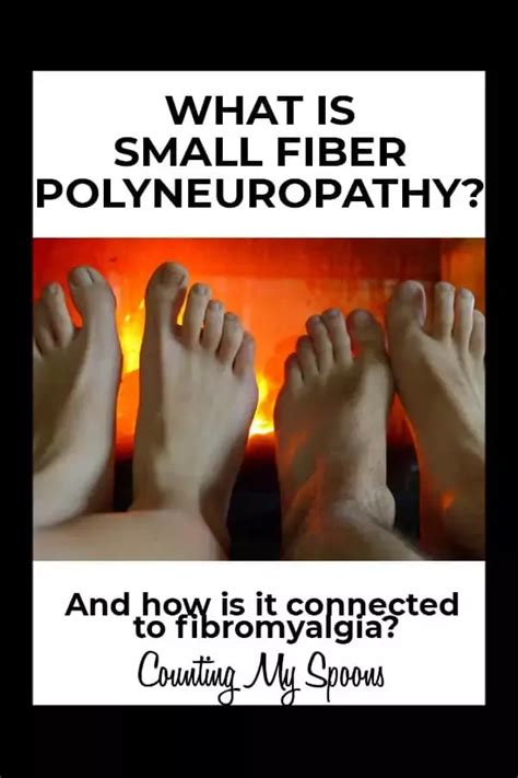 What Is Small Fiber Neuropathy Artofit