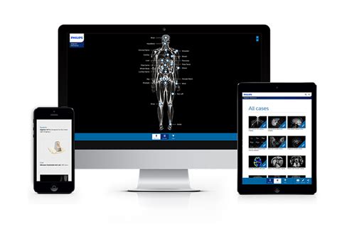 Magnetische Resonantie Philips Mri Systemen