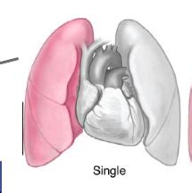 Physical Therapy And Lung Transplantation Cardiopulm Exam