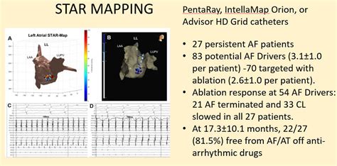 Prospective Star Guided Ablation In Persistent Atrial Fibrillation