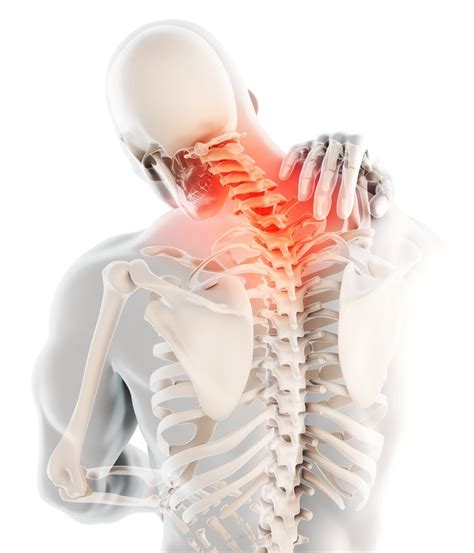 Spinal Wellness Care Best Ocala Chiropractor Auto Injury Back