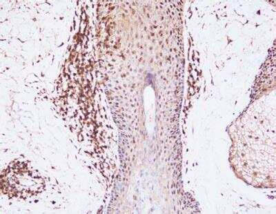 Baff Blys Tnfsf B Antibody Buffy Nbp By Novus Part Of