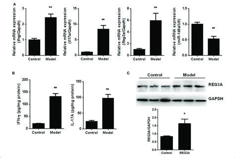 The Levels Of Regenerating Islet Derived Protein 3 Alpha REG3A And