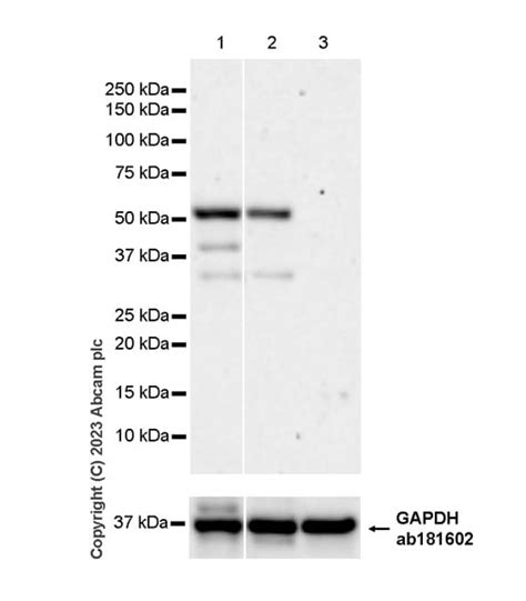 Recombinant Anti Hoxa Antibody Epr Ab Abcam