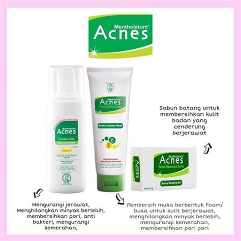 Jual ACNES TREATMENT SERIES Shopee Indonesia