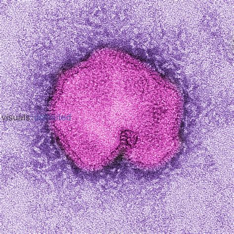 Influenza A (H7N9) virus. TEM | Visuals Unlimited