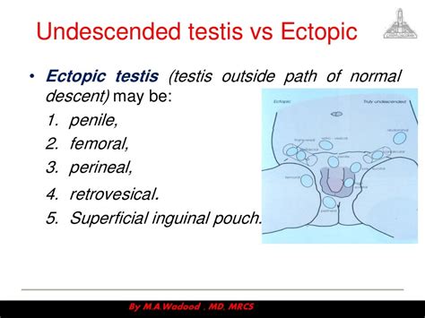 Congenital anomalies ppt