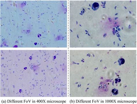 Unsupervised Toxoplasma Gondii Recognition By Fuzzy Cycle Generative