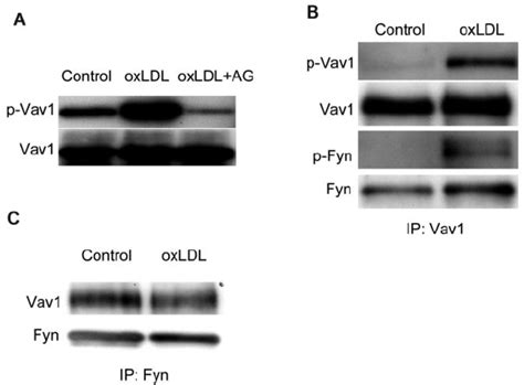 Oxldl Induced Vav Phosphorylation Is Mediated By Src Kinase Fyn A