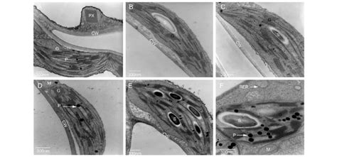 Transmission Electron Micrographs Of Chloroplasts In Tobacco Leaves Download Scientific