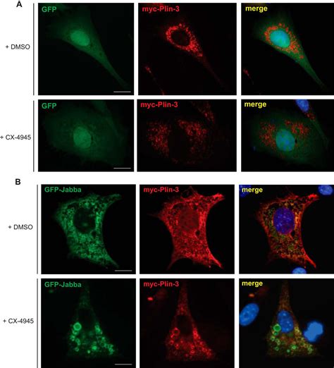 The Protein Kinase Ck Substrate Jabba Modulates Lipid Metabolism